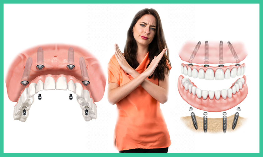 traitement invisalign
invisalign tarif